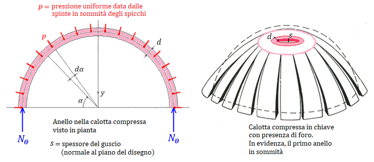 Calotta compressa in chiave, con presenza di foro e compressione circonferenziale nell’anello di sommità